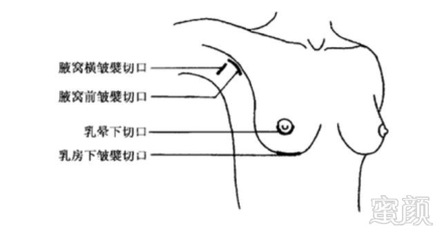 案例图片