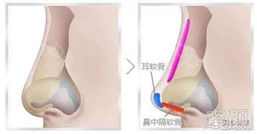 案例图片