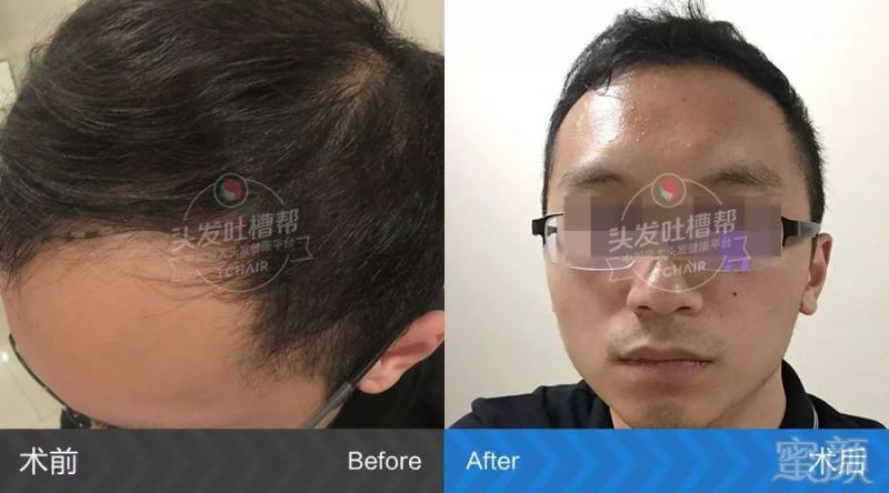 https://img.miyanlife.com/mnt/timg/180412/11194222O-1.jpg