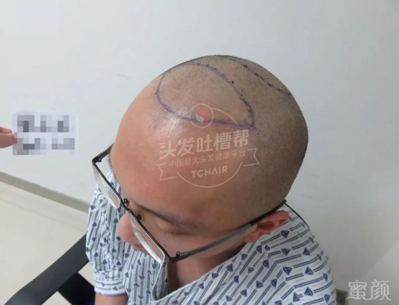 https://img.miyanlife.com/mnt/timg/180412/1119463I5-3.jpg
