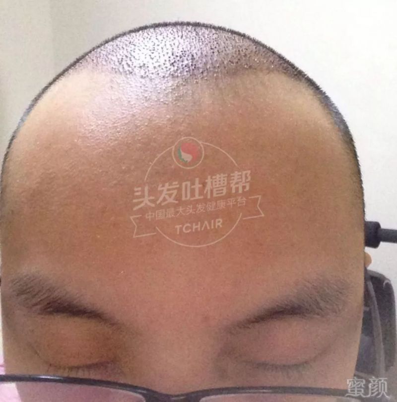 https://img.miyanlife.com/mnt/timg/180412/111950M60-5.jpg