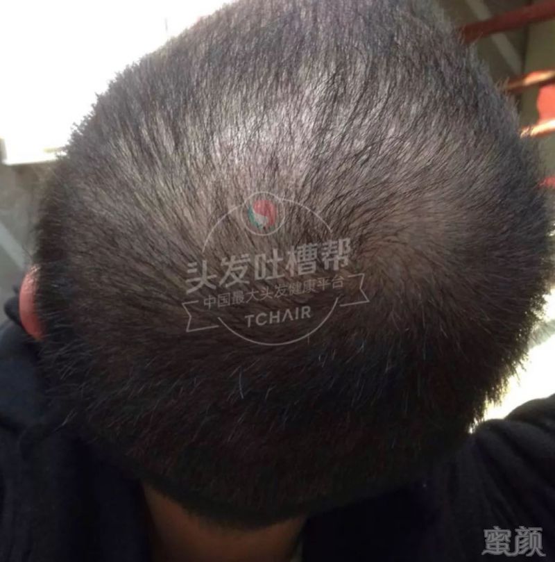 https://img.miyanlife.com/mnt/timg/180412/111954E23-6.jpg