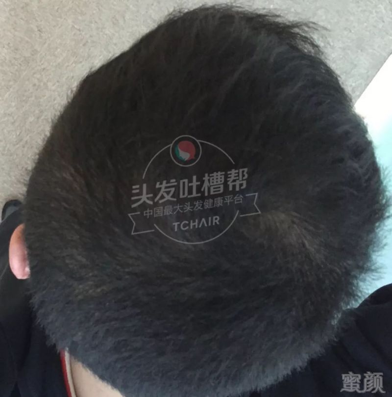 https://img.miyanlife.com/mnt/timg/180412/111955KE-7.jpg