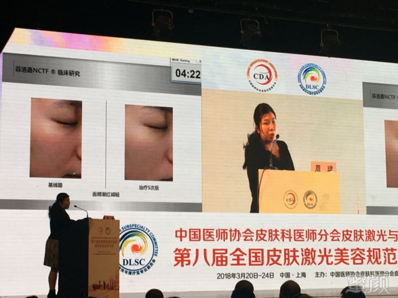 https://img.miyanlife.com/mnt/timg/180412/11255153N-7.jpg