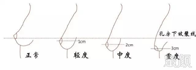 案例图片