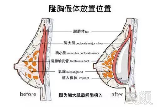 案例图片