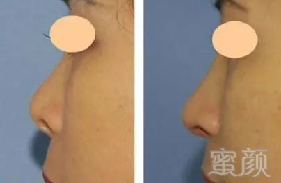 https://img.miyanlife.com/mnt/timg/180412/112P15310-6.jpg