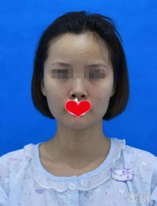 https://img.miyanlife.com/mnt/timg/180412/112P22912-10.jpg
