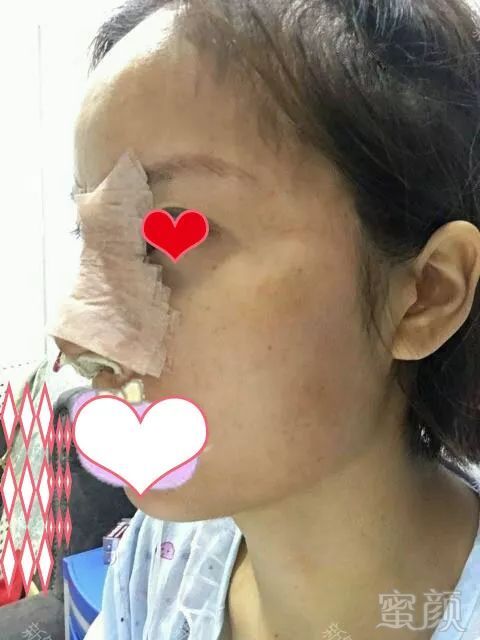 https://img.miyanlife.com/mnt/timg/180412/112P311c-11.jpg
