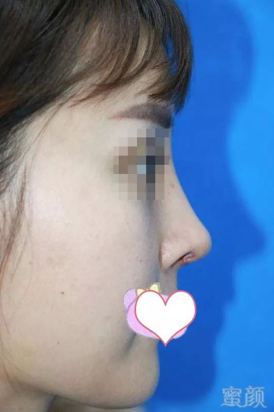 https://img.miyanlife.com/mnt/timg/180412/112P34642-12.jpg