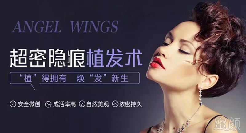 https://img.miyanlife.com/mnt/timg/180412/113440D48-4.jpg
