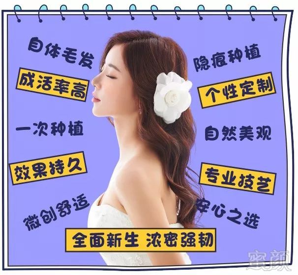 https://img.miyanlife.com/mnt/timg/180412/1134434T9-11.jpg