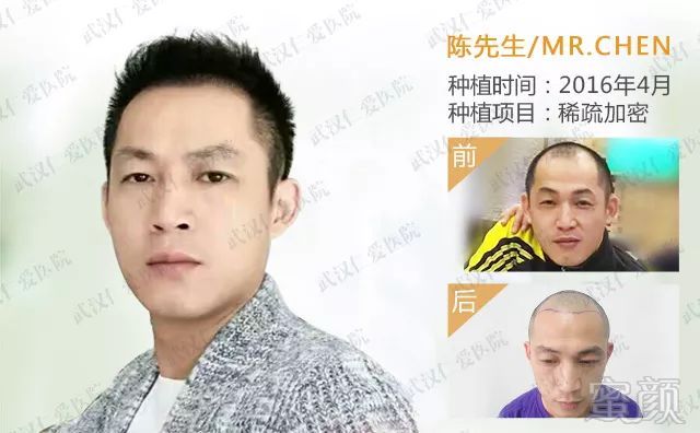 https://img.miyanlife.com/mnt/timg/180412/113AHH3-3.jpg