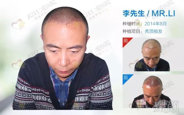 https://img.miyanlife.com/mnt/timg/180412/113AU113-4.jpg