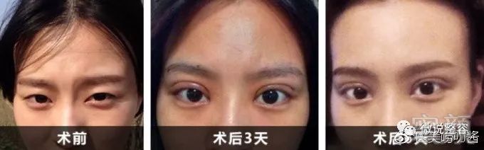 https://img.miyanlife.com/mnt/timg/180412/11404351a-1.jpg