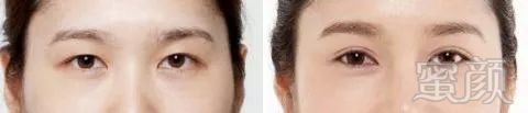 https://img.miyanlife.com/mnt/timg/180412/1215563N3-5.jpg