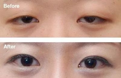 https://img.miyanlife.com/mnt/timg/180412/12155C628-2.jpg