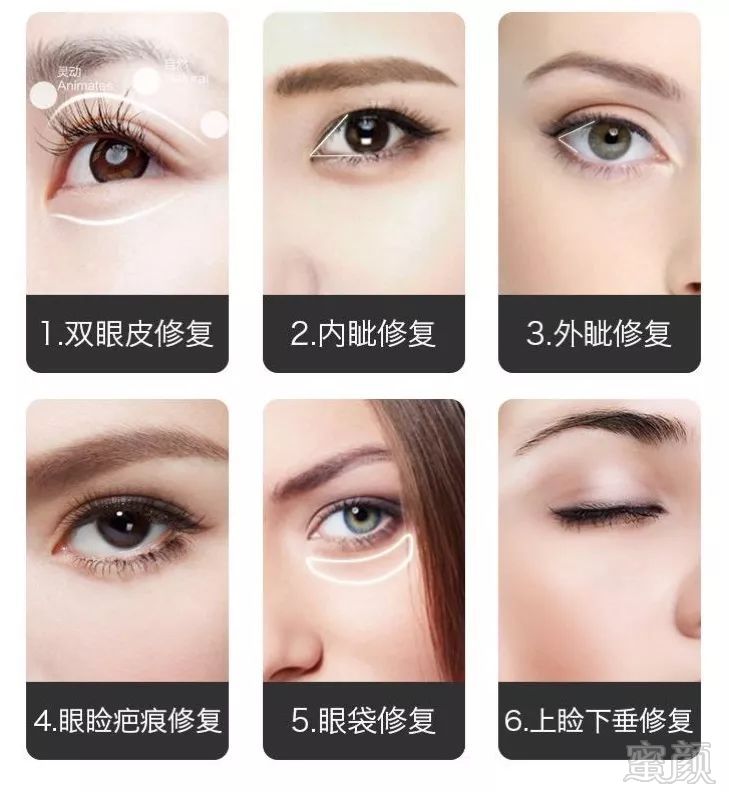 https://img.miyanlife.com/mnt/timg/180412/1226251214-1.jpg