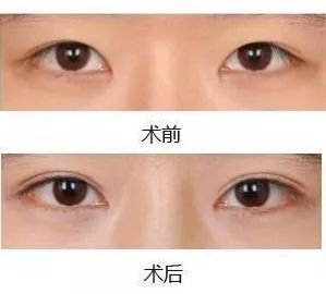 https://img.miyanlife.com/mnt/timg/180412/1226252432-4.jpg