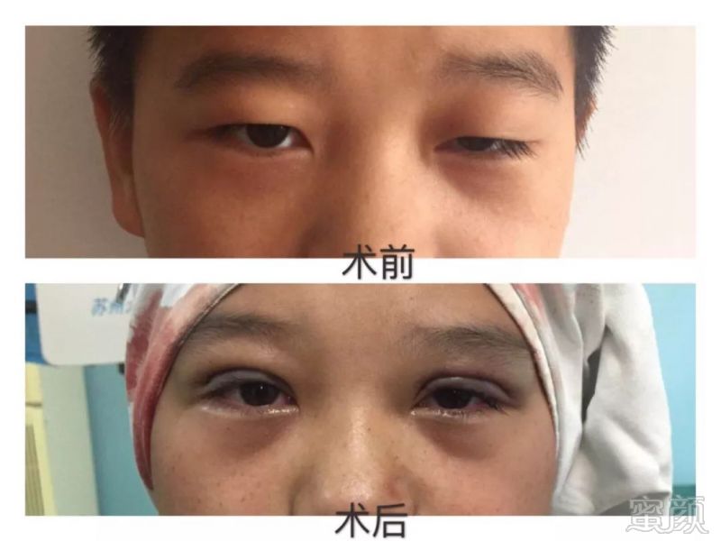 https://img.miyanlife.com/mnt/timg/180412/122629B62-11.jpg