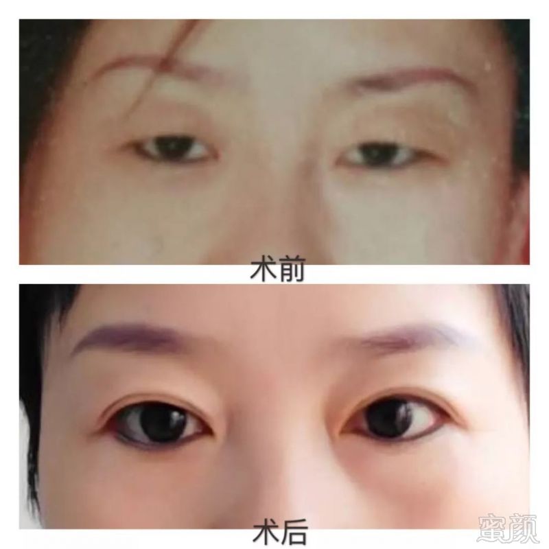 https://img.miyanlife.com/mnt/timg/180412/12262B100-6.jpg