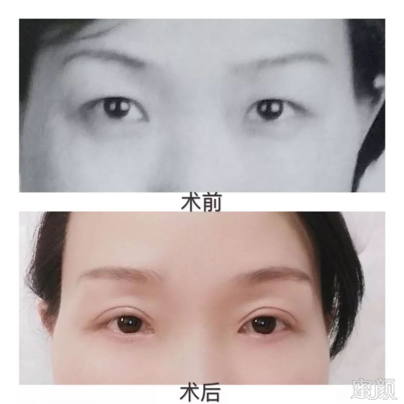 https://img.miyanlife.com/mnt/timg/180412/12262H3b-7.jpg
