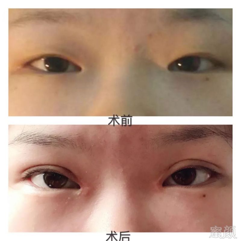 https://img.miyanlife.com/mnt/timg/180412/12262J9B-8.jpg