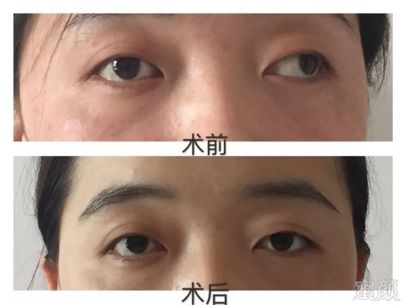 https://img.miyanlife.com/mnt/timg/180412/1226311260-12.jpg