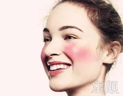 https://img.miyanlife.com/mnt/timg/180412/1245291231-0.jpg
