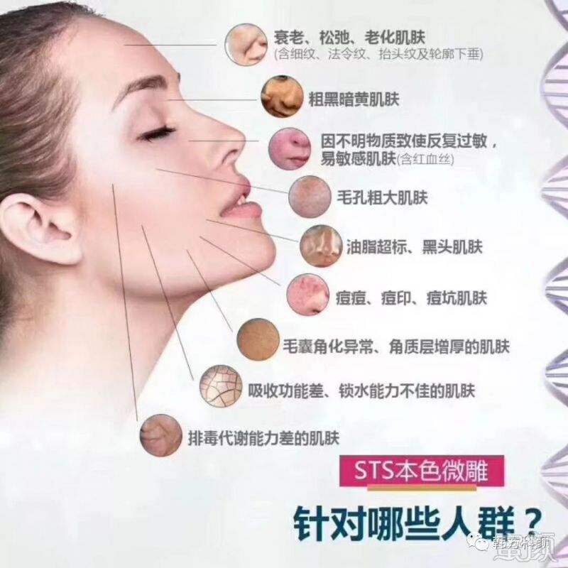 https://img.miyanlife.com/mnt/timg/180412/1245303141-3.jpg