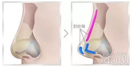 https://img.miyanlife.com/mnt/timg/180413/103635D16-2.jpg