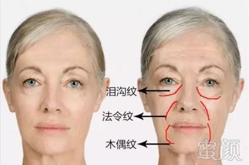 https://img.miyanlife.com/mnt/timg/180413/105623O35-0.jpg