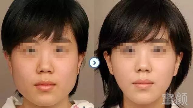 https://img.miyanlife.com/mnt/timg/180413/1142334915-4.jpg