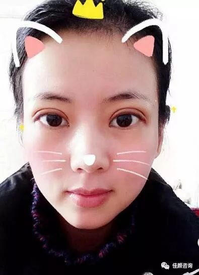 https://img.miyanlife.com/mnt/timg/180413/1204461403-4.jpg