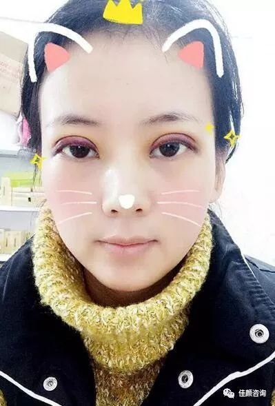 https://img.miyanlife.com/mnt/timg/180413/1204461N2-3.jpg