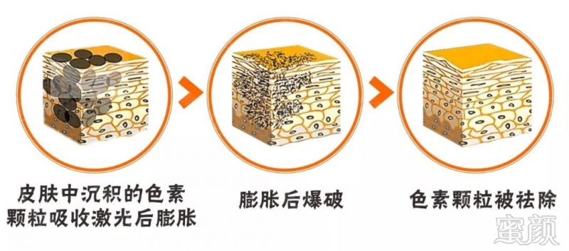 https://img.miyanlife.com/mnt/timg/180414/1049435M7-1.jpg