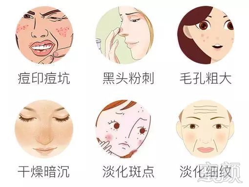 https://img.miyanlife.com/mnt/timg/180414/1131095O0-2.jpg