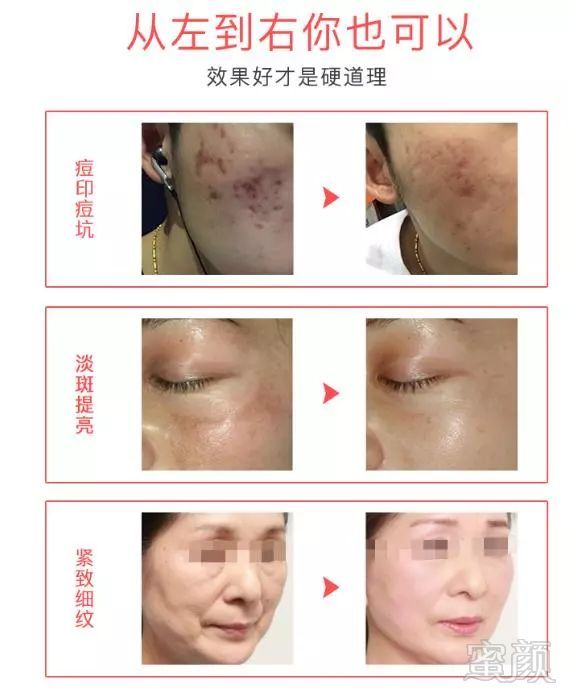 https://img.miyanlife.com/mnt/timg/180414/1131103958-9.jpg
