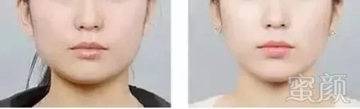 https://img.miyanlife.com/mnt/timg/180414/1133221F4-2.jpg