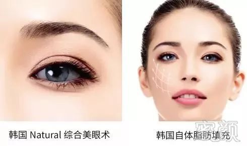 https://img.miyanlife.com/mnt/timg/180414/1251094642-16.jpg