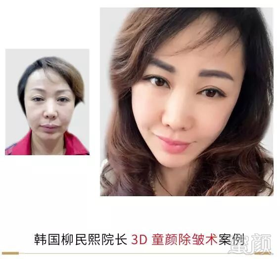 https://img.miyanlife.com/mnt/timg/180414/12511061C-18.jpg