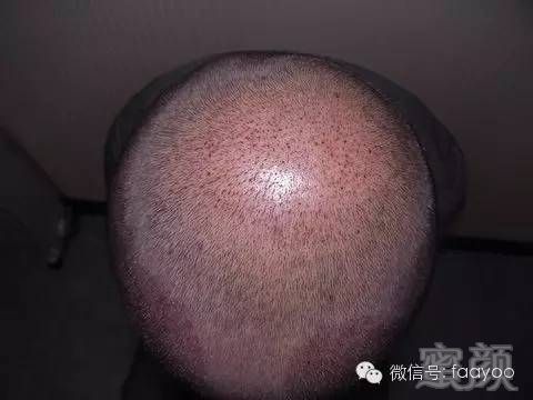 https://img.miyanlife.com/mnt/timg/180414/1334414420-3.jpg