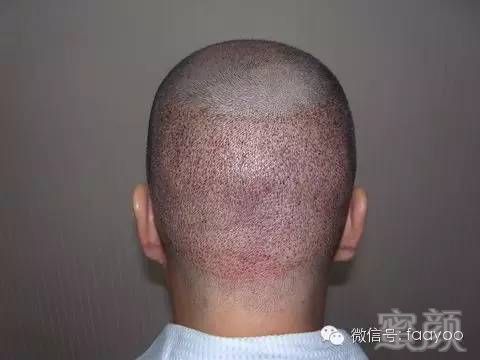 https://img.miyanlife.com/mnt/timg/180414/1334424G1-4.jpg