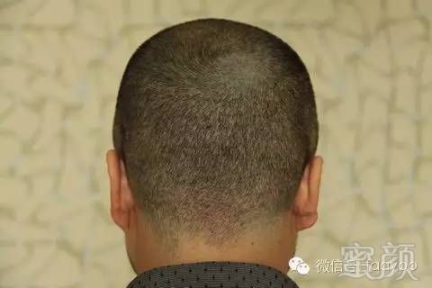 https://img.miyanlife.com/mnt/timg/180414/133442C20-6.jpg