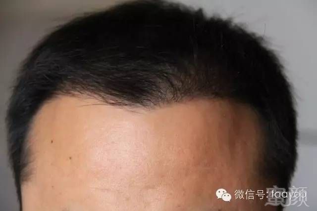 https://img.miyanlife.com/mnt/timg/180414/1334453400-15.jpg