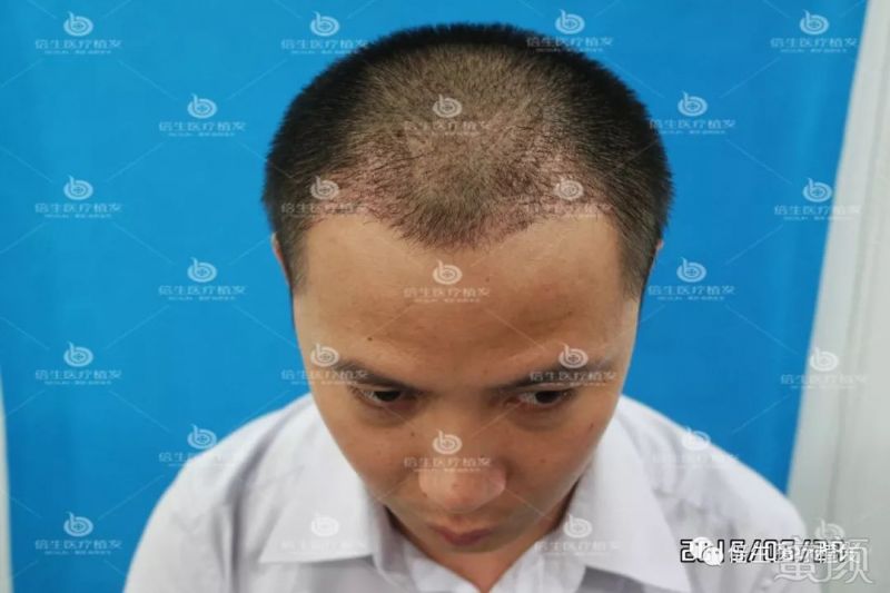 https://img.miyanlife.com/mnt/timg/180415/115ISN4-3.jpg