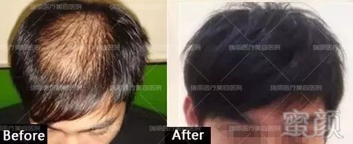 https://img.miyanlife.com/mnt/timg/180415/12100411B-5.jpg