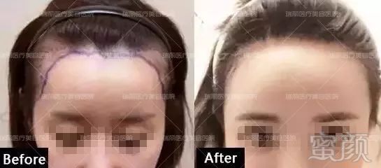 https://img.miyanlife.com/mnt/timg/180415/1210043A5-6.jpg