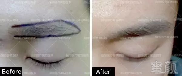 https://img.miyanlife.com/mnt/timg/180415/121004J07-8.jpg