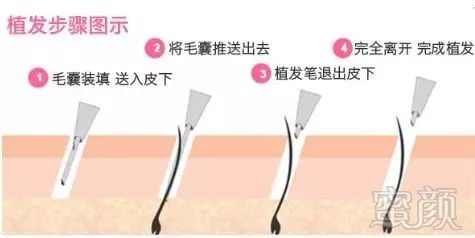 https://img.miyanlife.com/mnt/timg/180415/1210055130-10.jpg